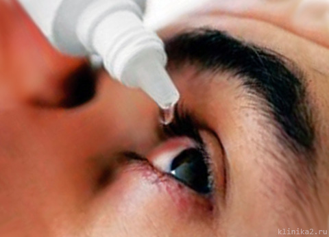 Как быстро вылечить вирусный конъюнктивит у взрослого